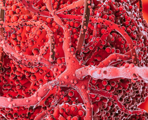 acidi-grassi-tumore-al-sangue