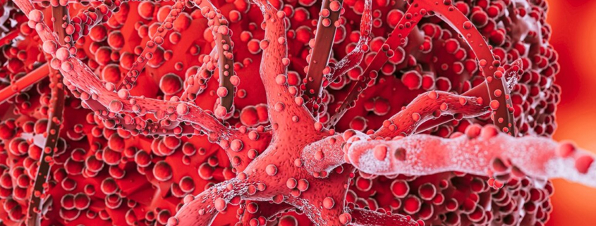 acidi-grassi-tumore-al-sangue