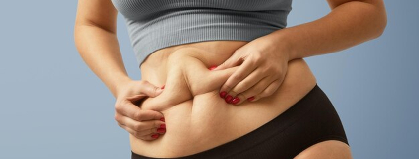 obesa