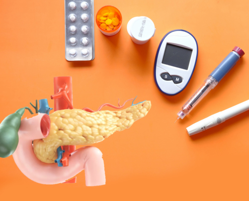 Diabete-e-tumore-al-pancreas